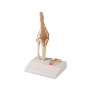Miniaturowy staw kolanowy z przekrojem poprzecznym