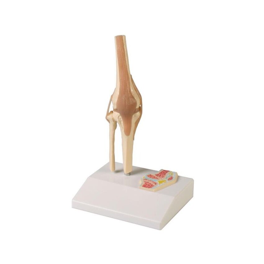 Miniaturowy staw kolanowy z przekrojem poprzecznym