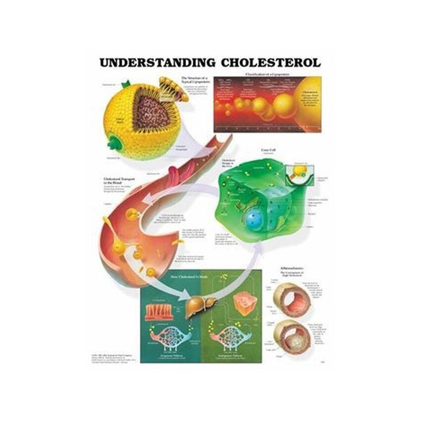 Zrozumieć cholesterol, plakat laminowany 51x66 cm
