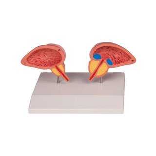 Model prostaty, 2-częściowy