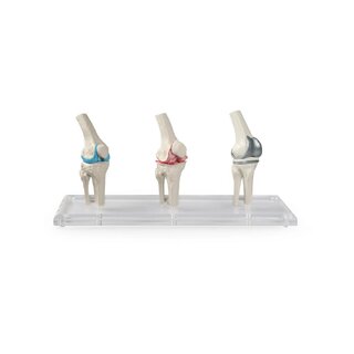 Model implantu kolana