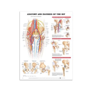 Plakat – Anatomia i urazy stawu biodrowego w języku angielskim