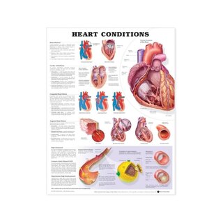 Plakat laminowany "Choroba serca"