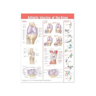 Urazy kolan po sporcie laminowany plakat angielski