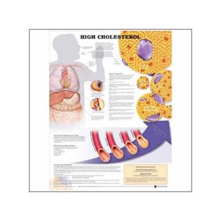 Laminowany plakat z otworami na pierścienie i informacją o wysokim poziomie cholesterolu